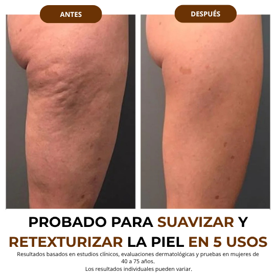 NUA MagicFirm™ Silk Body Oil | Reafirma Tu Piel Un 97% en 7 días