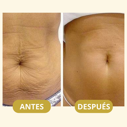 MagicFirm™ Aceite Corporal de Lujo | Reafirma la piel un 90% en 4 semanas - 100% GARANTIZADO