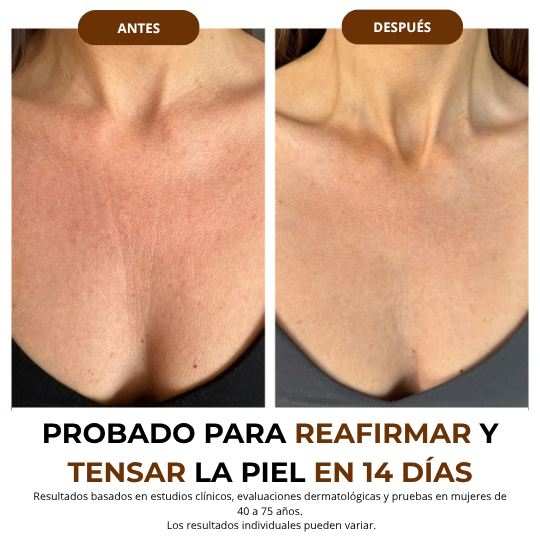 NUA MagicFirm™ Silk Body Oil | Reafirma Tu Piel Un 97% en 7 días