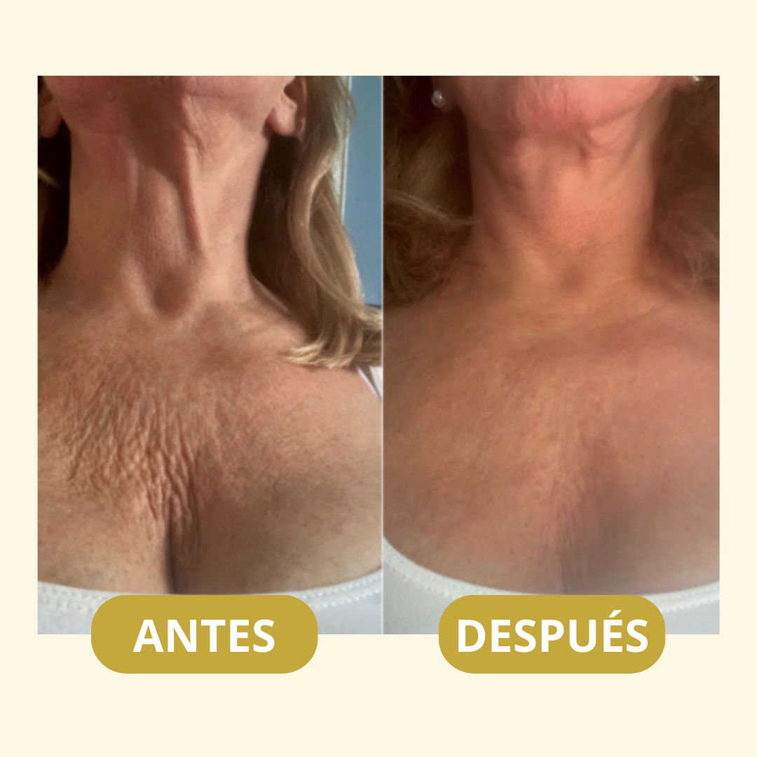 MagicFirm™ Aceite Corporal de Lujo | Reafirma la piel un 90% en 4 semanas - 100% GARANTIZADO
