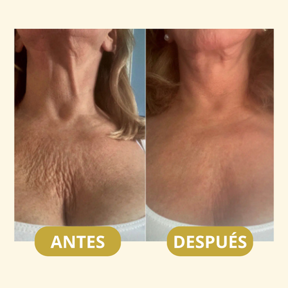 MagicFirm™ Aceite Corporal de Lujo | Reafirma la piel un 90% en 4 semanas - 100% GARANTIZADO