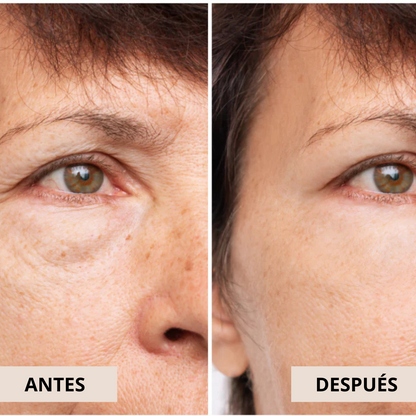 DIVINE™ Luxury Skincare Efecto BOTOX | Rostro perfecto en 2 semanas - 100% GARANTIZADO