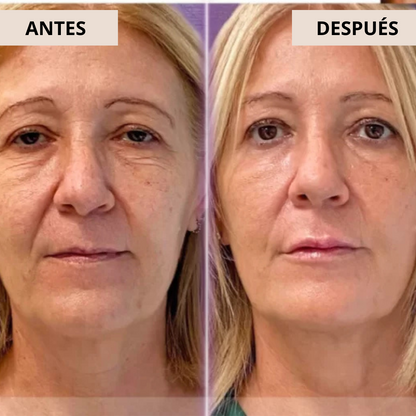 DIVINE™ Luxury Skincare Efecto BOTOX | Rostro perfecto en 2 semanas - 100% GARANTIZADO