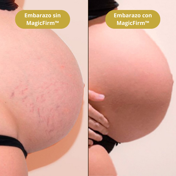 MagicFirm™ Aceite Corporal de Lujo | Reafirma la piel un 90% en 4 semanas - 100% GARANTIZADO