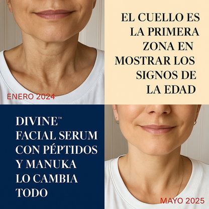 DIVINE™ Luxury Skincare Efecto BOTOX | Rostro perfecto en 2 semanas - 100% GARANTIZADO